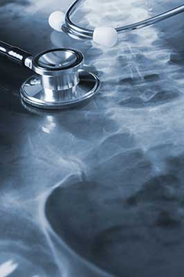 Spinal Cord Injuries in Bainbridge, WA